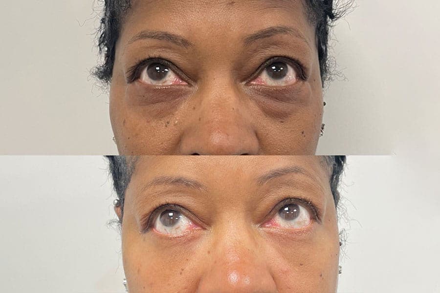 Before and after photograph of a patient of Dr. Karan Mehta