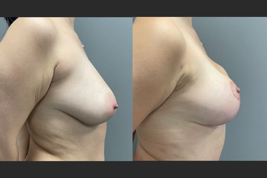 Before and after photograph of a patient of Dr. Karan Mehta